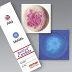 Thermo Scientific™ Remel™ BactiCard™ Candida Kit