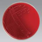 Thermo Scientific™ Remel™ Anaerobic Blood Agar, Monoplate