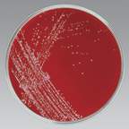 Thermo Scientific™ Remel™ Bordet Gengou Agar (with blood)