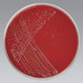 Campy Agar