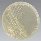 Thermo Scientific™ Middlebrook 7H11 Agar