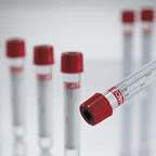 Greiner Bio-One VACUETTE™ Z Serum Blood Collection Tubes