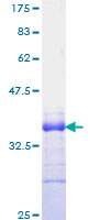 JAG1 (Human) Recombinant Protein (Q01), Abnova