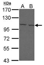 CD307e (FcRL5) Polyclonal Antibody, Invitrogen™