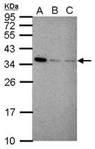 IFI35 Polyclonal Antibody, Invitrogen™