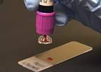 Typenex™ SmearSafe™ Blood Dispenser
