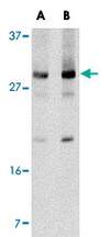Klra2, Rabbit, Polyclonal Antibody, Abnova™