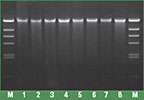 Thermo Scientific™ GeneJET Genomic DNA Purification Kit