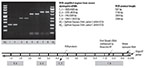 Thermo Scientific™ RevertAid First Strand cDNA Synthesis Kit