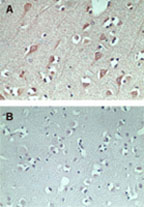 FAM3C, Rabbit, Polyclonal Antibody, Abnova™