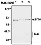 SYT6 Rabbit anti-Human, Polyclonal Antibody, Abnova™