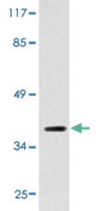 RAD51, Rat, Polyclonal Antibody, Abnova™