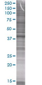 GNA15 293T Cell Overexpression Lysate (Denatured), Abnova
