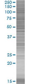 ZNF19 293T Cell Overexpression Lysate (Denatured), Abnova