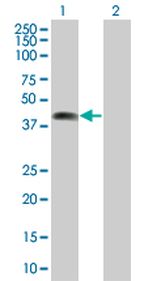 ZNF187 293T Cell Overexpression Lysate (Denatured), Abnova