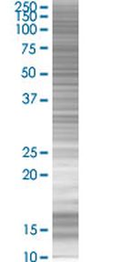 ZNF266 293T Cell Overexpression Lysate (Denatured), Abnova