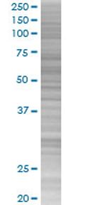 ZNF490 293T Cell Overexpression Lysate (Denatured), Abnova