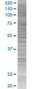 ZNF567 293T Cell Overexpression Lysate (Denatured), Abnova