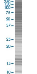 ZNF596 293T Cell Overexpression Lysate (Denatured), Abnova