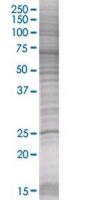 GSTK1 293T Cell Overexpression Lysate (Denatured), Abnova