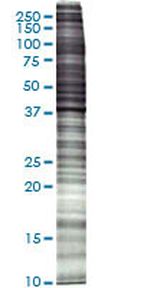 NIH/3T3 (mouse NIH/Swiss embryo) Whole cell lysate, Denatured; Abnova