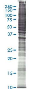Raw 264.7 (mouse macrophage, Abelson murine leukemia virus transformed) Whole cell lysate, Denatured; Abnova