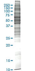 Raw 264.7 (mouse macrophage, Abelson murine leukemia virus transformed) Whole cell lysate, Non-denatured; Abnova
