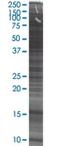 Sp2/0-Ag14 (mouse hybridoma) Whole cell lysate, Non-denatured; Abnova